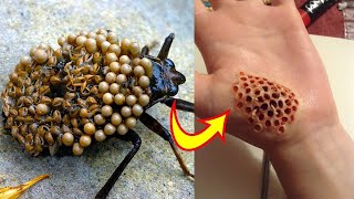 Top 10 Insectos Y Arácnidos Más Peligrosos Del Mundo [upl. by Kosey]