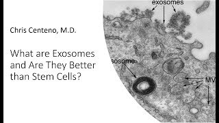 What are Exosomes Are They Better than Stem Cells [upl. by Beitnes]