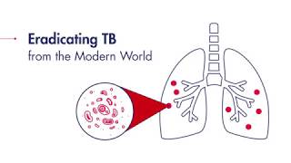 Eradicating TB from the modern world [upl. by Anidal]