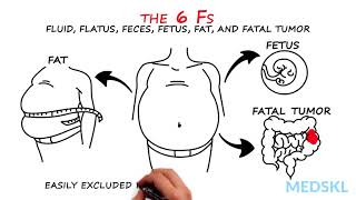 Abdominal Distension The 6 Fs that can help your diagnosis [upl. by Tracy]