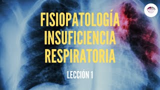 1 FISIOPATOLOGÍA DE LA INSUFICIENCIA RESPIRATORIA FISIOPATOLOGÍA RESPIRATORIA [upl. by Relluf]