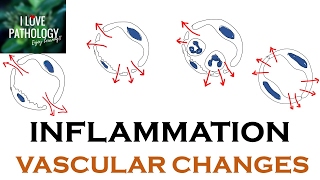 INFLAMMATION Part 1 General concepts types  Vascular changes in Acute inflammation [upl. by Jumbala]