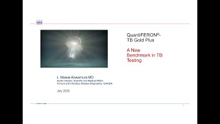 3QuantiFERONTB Gold Plus A New Benchmark in TB TestingDr Masae Kawamura [upl. by Avron]