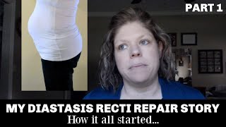 My Diastasis Recti Repair Story  From Exercises to Surgery [upl. by Gorman]