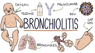 Bronchitis  Spooky2 Rife Frequencies [upl. by Furlani]