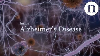 Inside Alzheimer’s disease [upl. by Adis924]