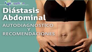 DIÁSTASIS ABDOMINAL  AUTODIAGNÓSTICO y RECOMENDACIONES  Fisiolution [upl. by Jala750]